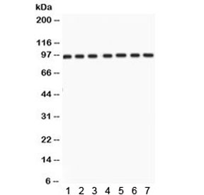 Western blot testing of 1) rat testis, 2) rat brain, 3) rat liver, 4) mouse testis, 5) human HeLa, 6) A431, and 7) HUT lysate with p95 NBS1 antibody. Predicted/observed molecular weight ~95 kDa.