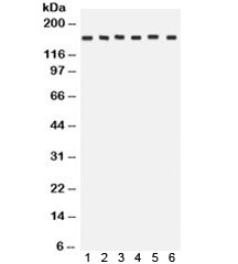 Western blot testing of 1) rat brain, 2) rat liver, 3) human HeLa, 4) CEM, 5) A549 and 6) MCF7 lysate with ROCK2 antibody.  Expected/observed molecular weight: ~161 kDa.