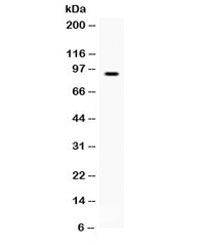 Western blot testing of human HepG2 cell lysate with BCAR3 antibody. Expected/observed molecular weight ~93 kDa.