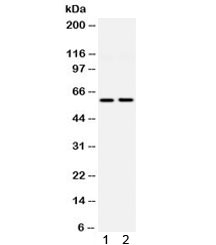 Western blot testing of 1) rat kidney and 2) human HeLa lysate with DGAT antibody. Predicted molecular weight: ~57 kDa.