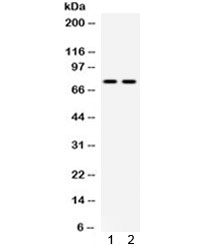 Western blot testing of mouse 1) kidney and 2) NIH3T3 lysate with ZBTB7A antibody. Predicted molecular weight ~61 kDa but routinely observed at ~75 kDa.