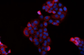 Immunofluorescent staining of FFPE human A431 cells with BAG2 antibody (red) and DAPI nuclear stain (blue). HIER: steam section in pH6 citrate buffer for 20 min. 