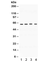 Western blot testing of 1) rat brain, 2) rat testis, 3) human MCF7 and 4) human HeLa lysate with BAG3 antibody. Predicted molecular weight ~62 kDa but can be observed at 75~80 kDa.