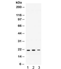 Western blot testing of 1) rat brain, 2) mouse brain, and 3) mouse HEPA lysate with HRAS antibody. Expected/observed molecular weight ~21 kDa.