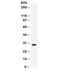 Western blot testing of rat brain lysate with PrP antibody. Expected molecular weight: 20-29 kDa.