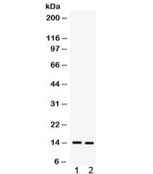 Western blot testing of 1) human A431 and 2) MCF7 cell lysate with S100A9 antibody. Expected/observed molecular weight ~14 kDa.