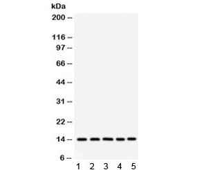 Western blot testing of 1) rat liver, 2) mouse liver, 3) human SMMC, 4) HepG2 and 5) RH35 lysate with FABP antibody. Predicted/observed molecular weight: ~14 kDa.