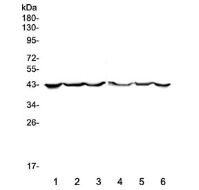 Western blot testing of human 1) placenta, 2) MCF7, 3) SW620, 4) COLO-320, 5) HepG2 and 6) PANC-1 lysate with CK19 antibody. Expected molecular weight ~43 kDa.