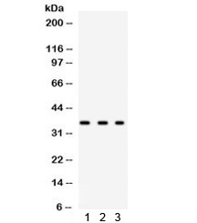 Western blot testing of human 1) HeLa, 2) 293 and 3 MCF7 lysate with SPARC antibody. Observed molecular weight: 35~43 kDa, depending on glycosylation level.