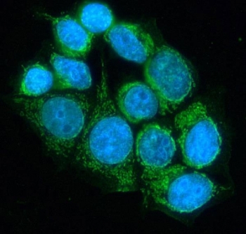 Immunofluorescent staining of FFPE human MCF7 cells with DLD antibody (green) and DAPI nuclear stain (blue). HIER: steam section in pH6 citrate buffer for 20 min.
