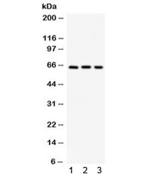 Western blot testing of 1) mouse pancreas, 2) human Jurkat and 3) human HepG2 lysate with SPP1 antibody. Expected/observed molecular weight: 35/60-65 kDa (unmodified/glycosylated).