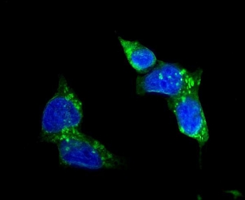 Immunofluorescent staining of FFPE human HepG2 cells with SLC2A1 antibody (green) and DAPI nuclear stain (blue). HIER: steam section in pH6 citrate buffer for 20 min.