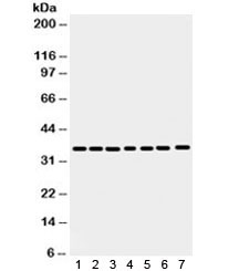 Western blot testing of 1) rat spleen, 2) rat stomach, 3) human HeLa, 4) 22RV1, 5) A549, 6) MCF7 and 7) SW620 antibody with Annexin A3 antibody. Predicted/observed molecular weight ~36 kDa.