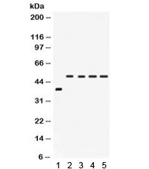 Western blot testing of 1) rat intestine and human 2) SW620, 3) COLO320, 4) HeLa and 5) A549 lysate with IRF2 antibody. Estimated molecular weight: ~39 kDa but routinely observed at 39-50 kDa.
