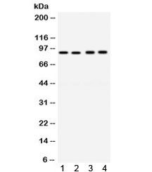 Western blot testing of human 1) Raji, 2) A549, 3) MCF7, and 4) SW620 cell lysate with anti-CD19 antibody. Expected molecular weight: 60~100 kDa depending on glycosylation level.