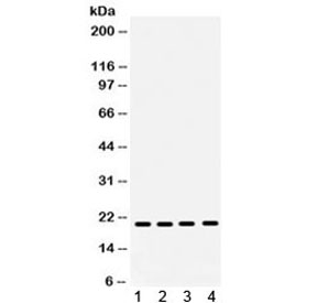 Western blot testing of 1) rat brain, 2) rat liver, 3) human HeLa and 4) mouse NIH3T3 lysate with NM23 antibody. Expected molecular weight: 17/20 kDa (NM23-H1A/-H1B).