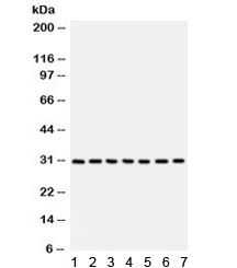 Western blot testing of 1) rat liver, 2) rat lung, 3) human HeLa, 4) A549, 5) MM231, 6) SW620 and 7) 22RV1 with NQO1 antibody. Predicted/observed molecular weight ~30 kDa.