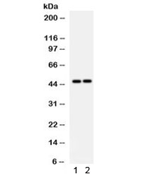 Western blot testing of human 1) HeLa and 2) Jurkat lysate with PTPN2 antibody. Predicted/observed molecular weight ~48 kDa.
