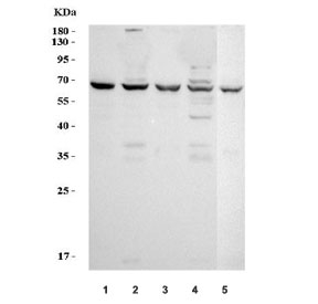 Western blot testing of 1) human SW620, 2) human COLO-320, 3) human ThP-1, 4) human K562 and 5) mouse ANA-1 cell lysate with TNFRSF1B antibody. Predicted molecular weight: 50~80 kDa depending on glycosylation level.