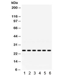 Western blot testing of 1) rat brain, 2) mouse brain, and human 3) HeLa, 4) SW620, 5) 293 and 6) Jurkat lysate with RAB5 antibody. Expected/observed molecular weight ~25 kDa.