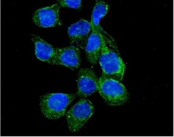 Immunofluorescent staining of FFPE human A431 cells with RASGAP antibody (green) and DAPI nuclear stain (blue). HIER: steam section in pH6 citrate buffer for 20 min.