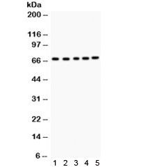 Western blot testing of 1) rat kidney, 2) mouse liver, 3) human HeLa, 4) PANC and 5) COLO320 lysate with ACHE antibody. Expected/observed molecular weight ~67 kDa.