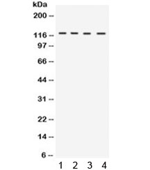 Western blot testing of 1) rat liver, 2) mouse liver, 3) mouse testis and 4) human HeLa lysate with UBA1 antibody. Expected molecular weight: ~118/114 kDa (isoforms a/b).