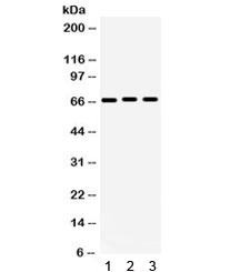 Western blot testing of human 1) 293, 2) A549 and 3) PANC cell lysate with KCNA5 antibody. Expected/observed molecular weight ~67 kDa.