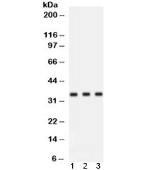 Western blot testing of human 1) placenta, 2) HeLa and 3) 293 lysate with Cyclin D1 antibody. Predicted molecular weight: 32-36 kDa.