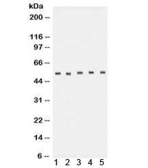 Western blot testing of 1) human placenta, 2) rat lung, 3) rat brain, 4) U87 and 5) A431 lysate with TACR1 antibody. Predicted molecular weight ~46 kDa but routinely observed at ~58 kDa.