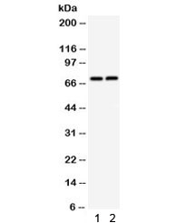 Western blot testing of 1) rat thymus and 2) mouse thymus lysate with TNFRSF1B antibody. Predicted molecular weight: 50/70~80 kDa (unmodified/glycosylated).