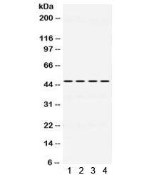 Western blot testing of 1) rat brain, 2) mouse brain, 3) human U87 and 4) human HeLa lysate with PAX6 antibody. Expected/observed molecular weight ~48 kDa.