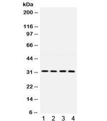 Western blot testing of rat 1) lung, 2) kidney, 3) thymus, and 4) mouse kidney lysate with LOX antibody. Expected molecular weight: ~47 kDa (unprocessed/unmodified), ~50 kDa (glycosylated), ~32 kDa (processed form).