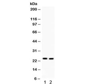 Western blot testing of 1) mouse lung and 2) mouse intestine lysate with LCN2 antibody. Predicted/observed molecular weight: 22-25 kDa.