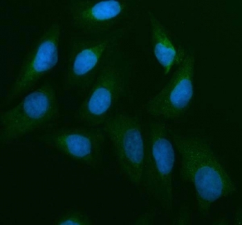 Western blot testing of 1) rat liver and 2) rat testis with CDC25B antibody. Expected/observed molecular weight: 61~67 kDa (isoforms 1-4).