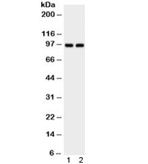 Western blot testing of 1) rat brain and 2) mouse liver lysate with AHR antibody. Expected/observed molecular weight ~95 kDa.