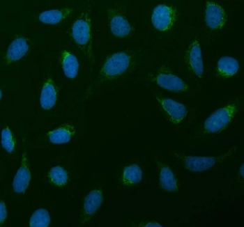 Immunofluorescent staining of FFPE human U-2 OS cells with SDHA antibody (green) and DAPI nuclear stain (blue). HIER: steam section in pH6 citrate buffer for 20 min.