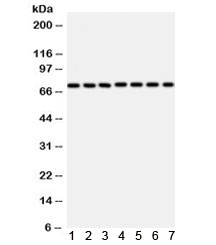 Western blot testing of 1) rat liver, 2) mouse liver, 3) rat brain, 4) mouse brain, 5) SMMC, 6) human placenta, and 7) SW620 lysate with SDHA antibody. Expected/observed molecular weight ~73 kDa.