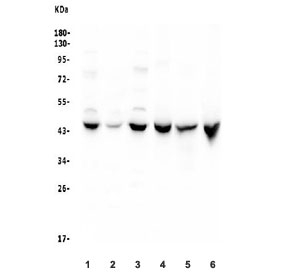 Western blot testing of 1) human K562, 2) human HepG2, 3) rat RH35, 4) rat liver, 5) rat kidney and 6) mouse liver lysate with Cystathionase antibody. Predicted molecular weight ~44 kDa.