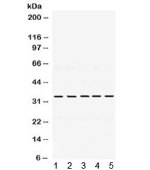 Western blot testing of 1) rat kidney, 2) mouse ovary, 3) human HeLa, 4) human MCF7 and 5) human SMMC lysate with TIMP3 antibody. Expected/observed molecular weight: ~24/33 kDa (unmodified/glycosylated).