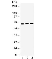 Western blot testing of 1) rat liver, 2) rat kidney, 3) human SW620 lysate with HNF1 beta antibody. Predicted/observed molecular weight ~61 kDa.