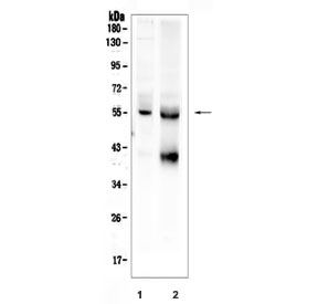 Western blot testing of human 1) HeLa and 2) SW579 cell lysate with TGFBR1 antibody. Expected molecular weight ~55 kDa.