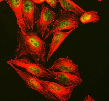 Immunofluorescent staining of FFPE human U-2 OS cells with CTCF antibody (green) and Alpha Tubulin mAb (red). HIER: steam section in pH6 citrate buffer for 20 min.