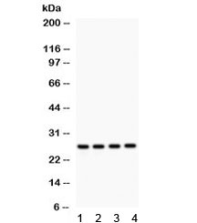 Western blot testing of 1) rat brain, 2) rat spleen, 3) rat kidney and 4) human SMMC lysate with Flt3 ligand antibody. Predicted/observed molecular weight ~26 kDa.