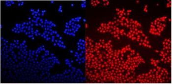 Immunofluorescent staining of FFPE human A431 cells with GNAQ antibody (red) and DAPI nuclear stain (blue). HIER: steam section in pH6 citrate buffer for 20 min.