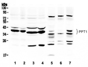 Western blot testing of 1) rat brain, 2) mouse brain, 3) rat liver, 4) mouse liver, 5) human HepG2, 6) human 293T and 7) MCF-7 lysate with PPT1 antibody. Expected/observed molecular weight ~34 kDa.