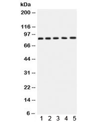 Western blot testing of 1) rat brain, 2) rat testis, 3) human SGC-7901, 4) 22RV1 and 5) MCF7 lysate with APLP1 antibody. Expected molecular weight: 76 kDa (unmodified), ~86 kDa (soluble/glycosylated form), 92~95 kDa (mature form).