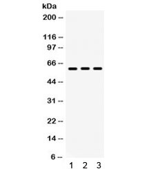 Western blot testing of mouse 1) testis, 2) thymus and 3) NIH3T3 lysate with Lumican antibody. Expected/observed moleculer weight: ~40/60 kDa (unmodified/glycosylated). (Ref 1)