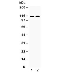 Western blot testing of 1) rat brain and 2) mouse brain with Eph Receptor A5 antibody. Expected/observed molecular weight ~114 kDa.