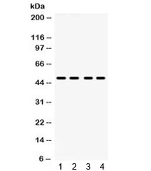 Western blot testing of human 1) HeLa, 2) COLO320, 3) SW620, 4) HepG2 lysate with PAR2 antibody. Expected molecular weight: 33-48 kDa (unmodified), 55-100 kDa (glycosylated). (Ref 1)